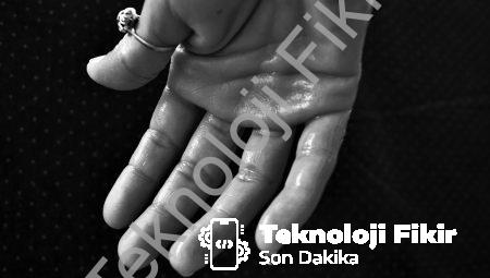 Hastayken Terlemek İyimidir?